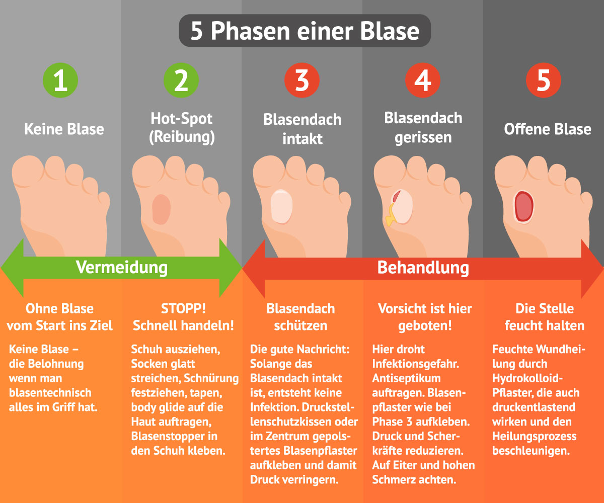 5 Phasen einer Blase